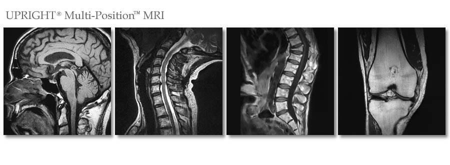 FONAR Upright MRI Images