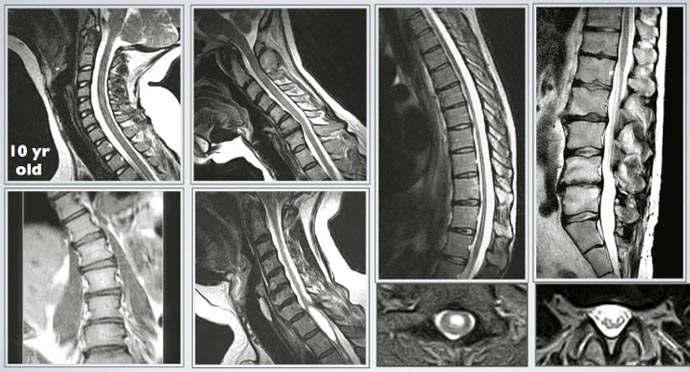 higspine imaging