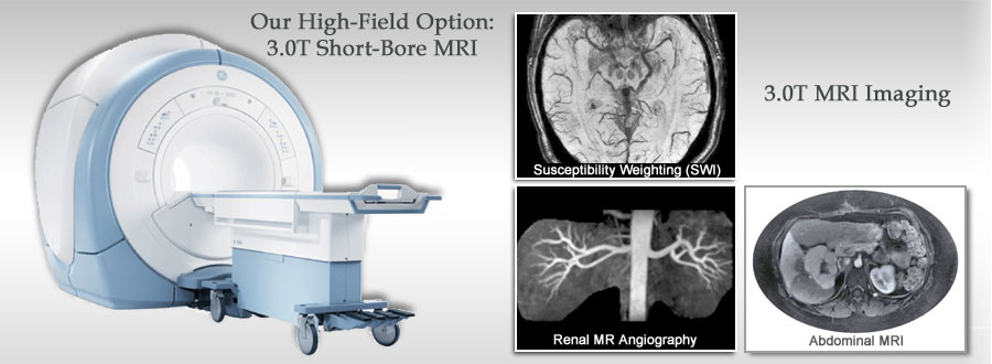 GE 3.0T Short-Bore MRI